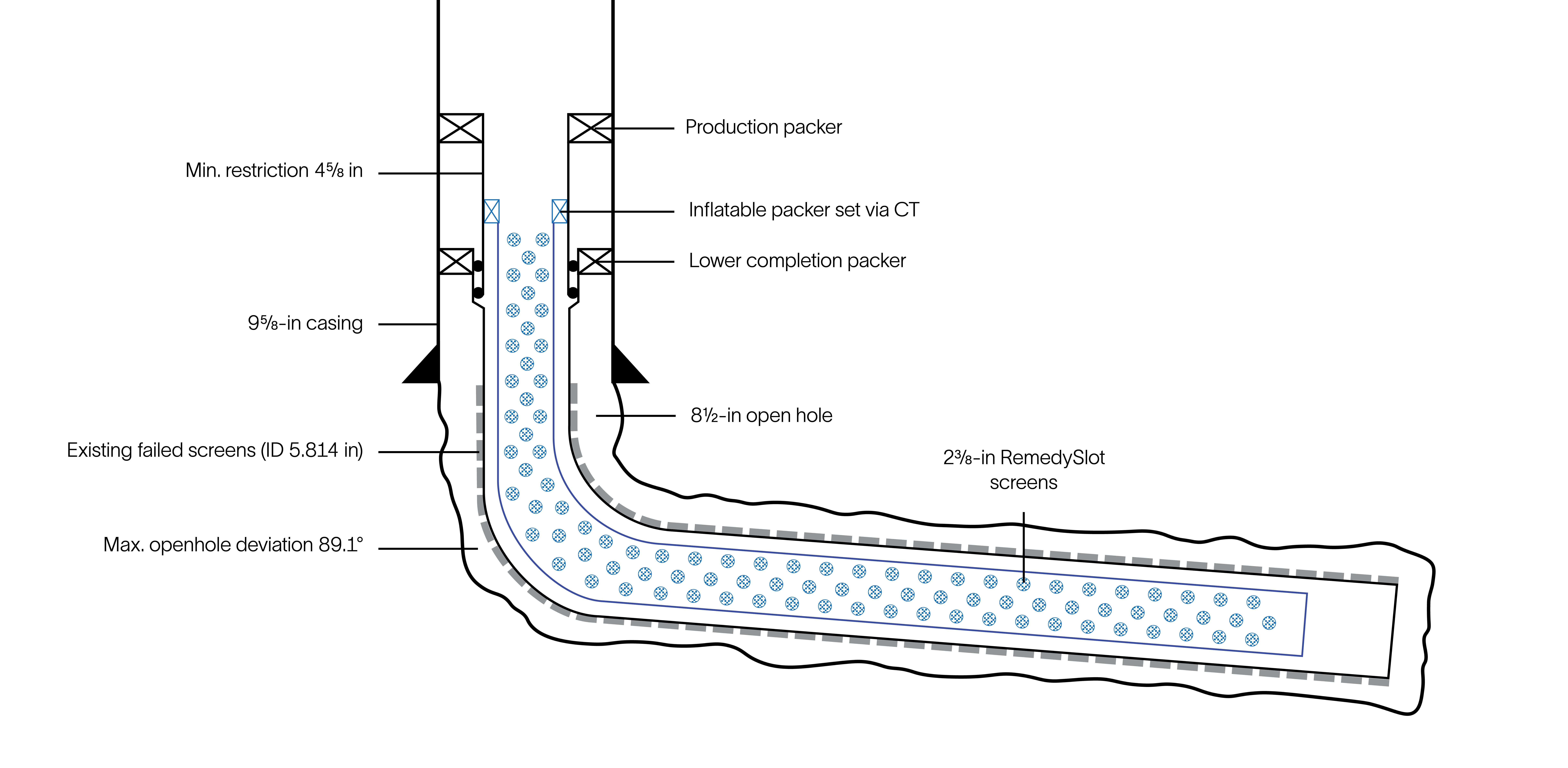 Completion schematic shows the original failed sand screens and the new RemedySlot thru-tubing screens.