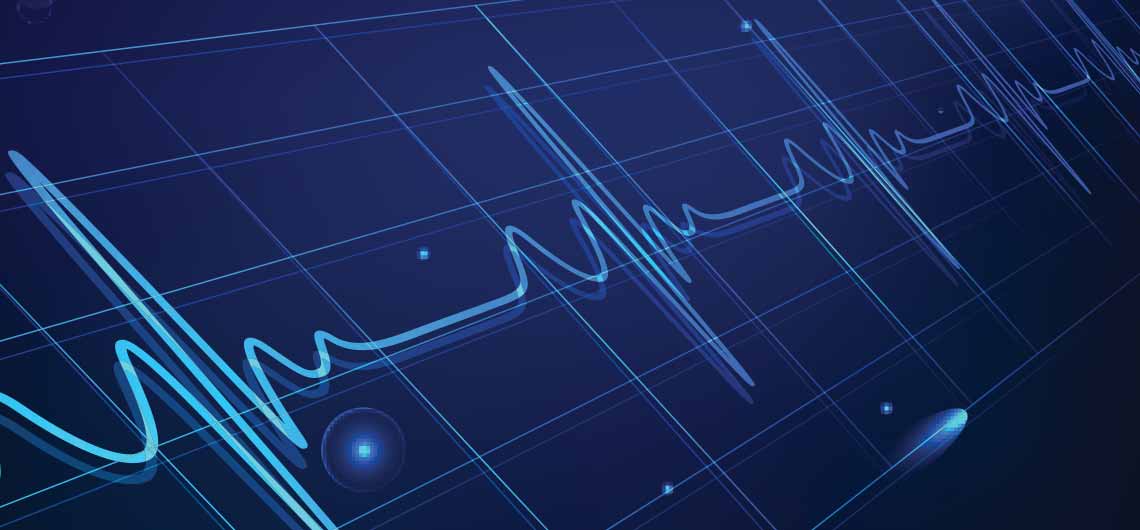 permanent downhole gauges