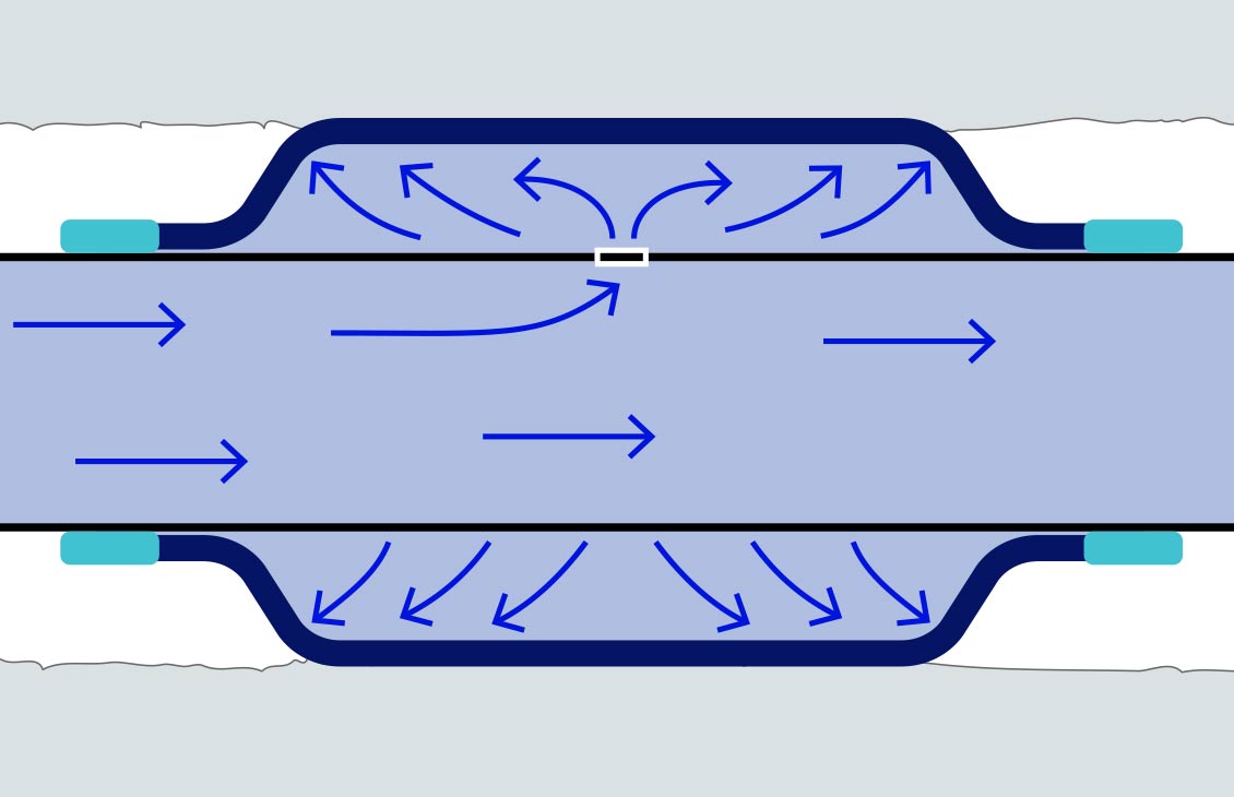 Schematic shows the setting process for an expandable steel external casing packer.