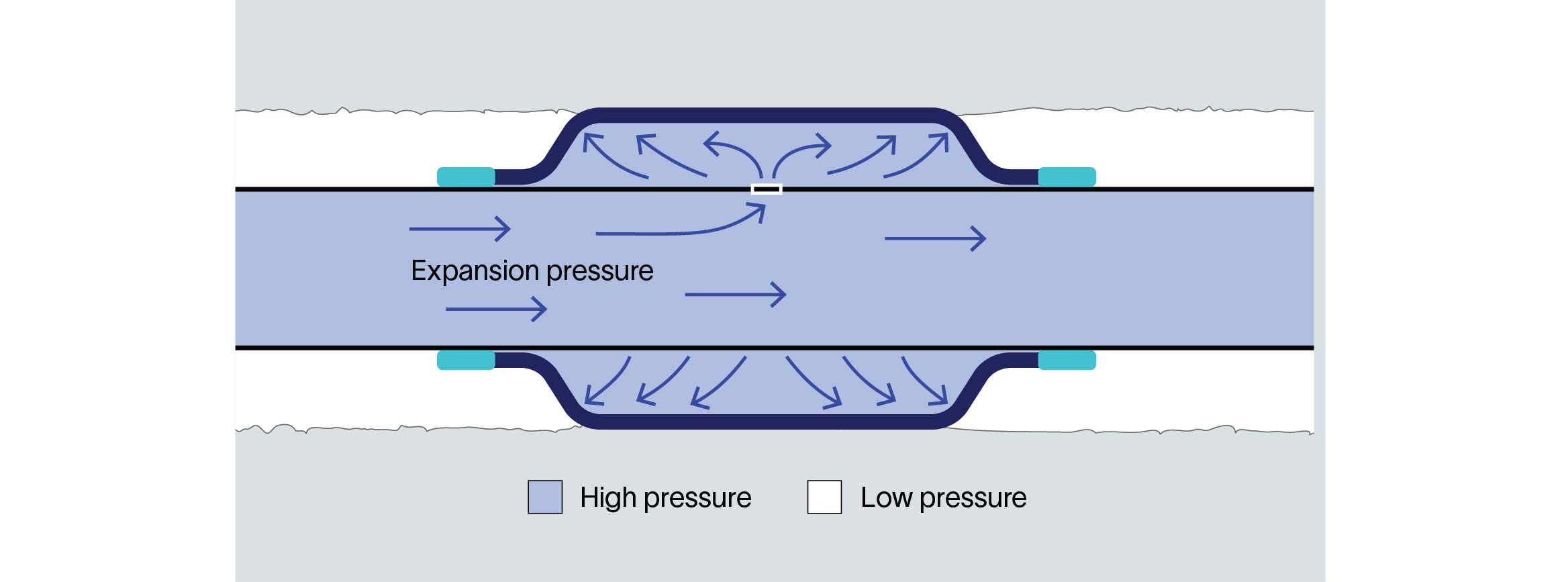 Schematic shows the setting process for an expandable steel external casing packer.