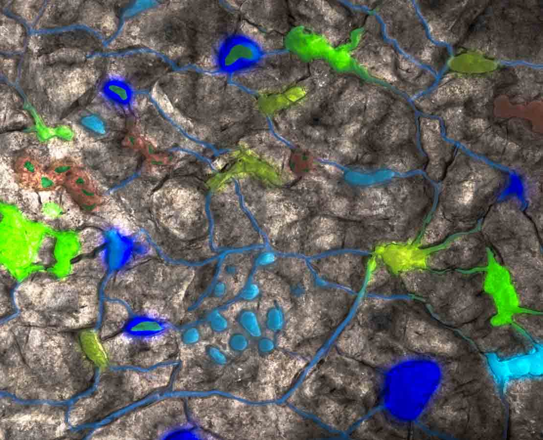 Fluids inside the smallest pores