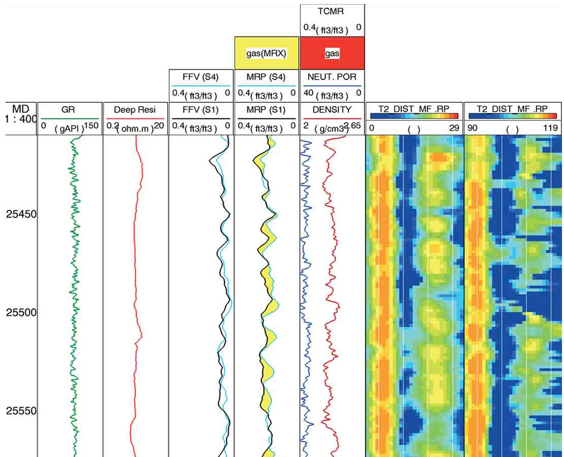 MR Scanner service radial profile