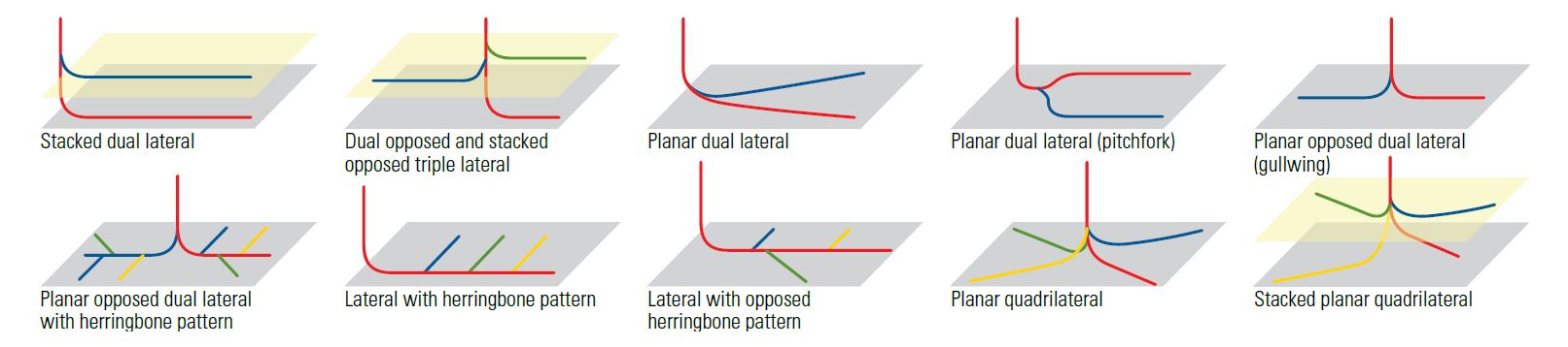 Stacked laterals.