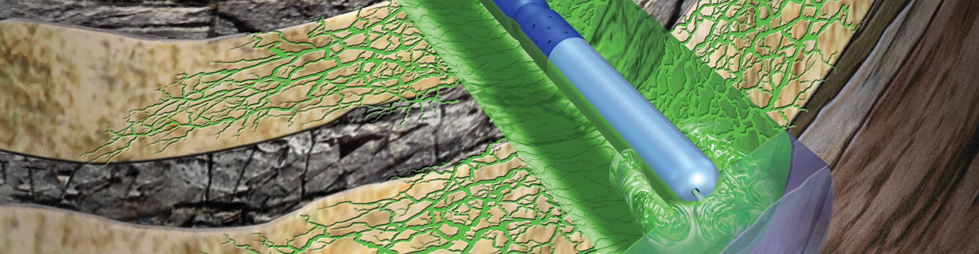 MaxCO3 Acid degradable diversion acid system